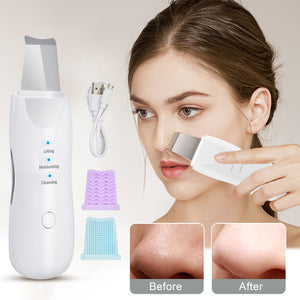 Ultrasonic Skin Scrubber - Deep Face Cleaning & Pore Blackhead Remover