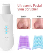 Ultrasonic Skin Scrubber - Deep Face Cleaning & Pore Blackhead Remover