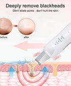 Ultrasonic Skin Scrubber - Deep Face Cleaning & Pore Blackhead Remover