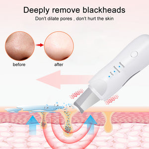 Ultrasonic Skin Scrubber - Deep Face Cleaning & Pore Blackhead Remover